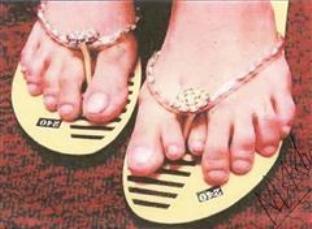Toes in yellow sandals